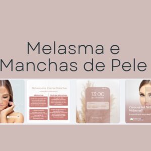 Melasma e manchas de pele